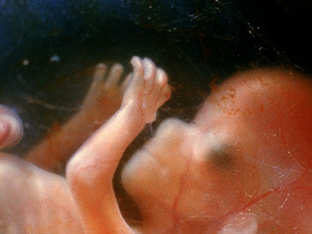 Конец 14 недели. 14 Недель беременности фото плода. Эмбрион на 14 неделе беременности фото. Эмбрион на 14 неделе беременности.